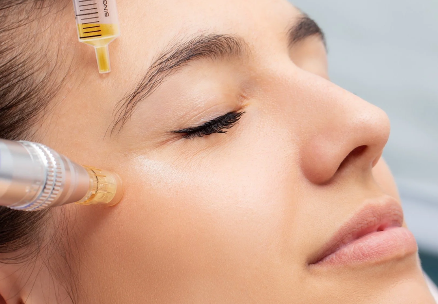 PRP Face Treatment